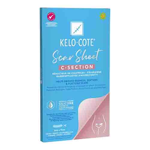 KELO-COTE Silikon-Narbenpflaster Kaiserschnitt